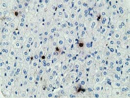 MICAL1 Antibody in Immunohistochemistry (Paraffin) (IHC (P))