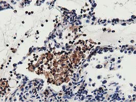 MICAL1 Antibody in Immunohistochemistry (Paraffin) (IHC (P))