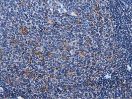 MICAL1 Antibody in Immunohistochemistry (Paraffin) (IHC (P))