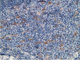 MICAL1 Antibody in Immunohistochemistry (Paraffin) (IHC (P))