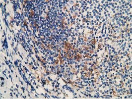 MICAL1 Antibody in Immunohistochemistry (Paraffin) (IHC (P))