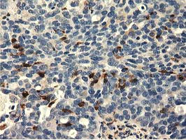 MICAL1 Antibody in Immunohistochemistry (Paraffin) (IHC (P))