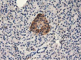 MICAL1 Antibody in Immunohistochemistry (Paraffin) (IHC (P))