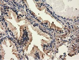 MICAL1 Antibody in Immunohistochemistry (Paraffin) (IHC (P))