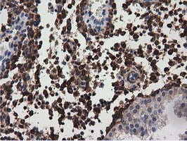 MICAL1 Antibody in Immunohistochemistry (Paraffin) (IHC (P))