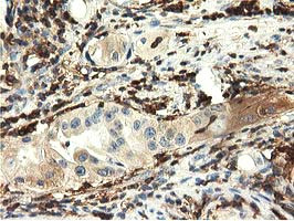 MICAL1 Antibody in Immunohistochemistry (Paraffin) (IHC (P))