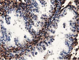 MICAL1 Antibody in Immunohistochemistry (Paraffin) (IHC (P))