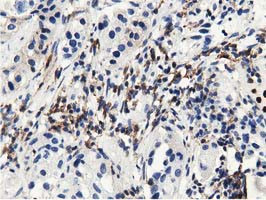 MICAL1 Antibody in Immunohistochemistry (Paraffin) (IHC (P))