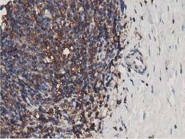 MICAL1 Antibody in Immunohistochemistry (Paraffin) (IHC (P))