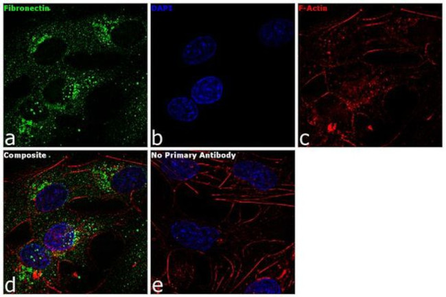 Fibronectin Antibody in Immunocytochemistry (ICC/IF)