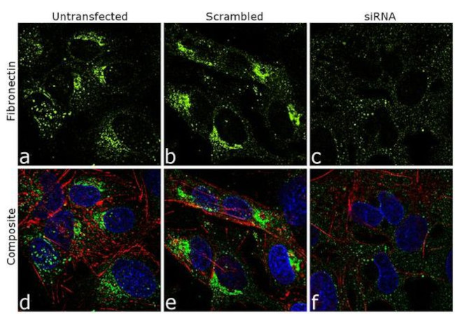 Fibronectin Antibody