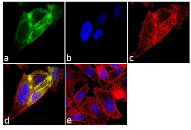 Follicle Stimulating Hormone Antibody in Immunocytochemistry (ICC/IF)