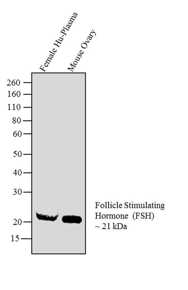 Follicle Stimulating Hormone Antibody in Western Blot (WB)