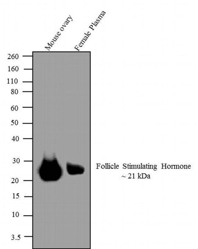 Follicle Stimulating Hormone Antibody in Western Blot (WB)
