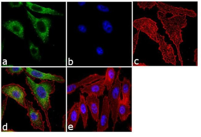 Follicle Stimulating Hormone Antibody in Immunocytochemistry (ICC/IF)