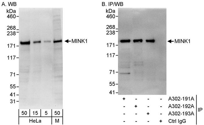 MINK1 Antibody in Western Blot (WB)