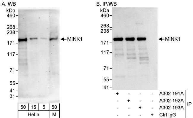 MINK1 Antibody in Western Blot (WB)