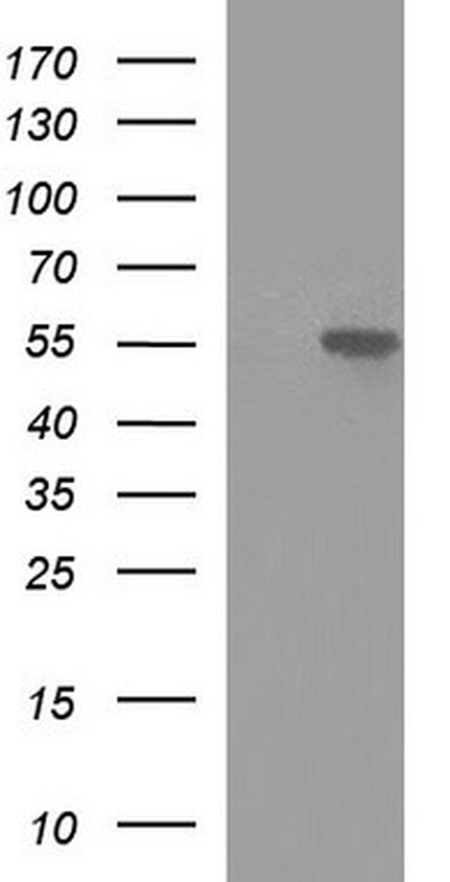 MINPP1 Antibody in Western Blot (WB)