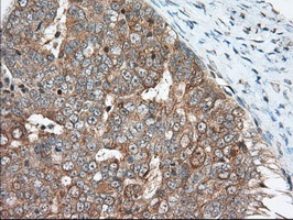 MIOX Antibody in Immunohistochemistry (Paraffin) (IHC (P))