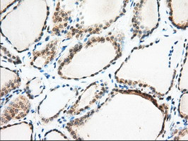 MIOX Antibody in Immunohistochemistry (Paraffin) (IHC (P))