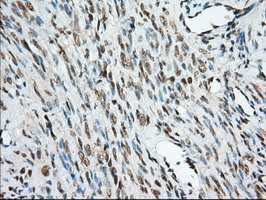 MIOX Antibody in Immunohistochemistry (Paraffin) (IHC (P))