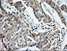 MIOX Antibody in Immunohistochemistry (Paraffin) (IHC (P))