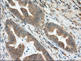 MIOX Antibody in Immunohistochemistry (Paraffin) (IHC (P))