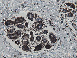 MIPEP Antibody in Immunohistochemistry (Paraffin) (IHC (P))