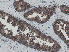 MIPEP Antibody in Immunohistochemistry (Paraffin) (IHC (P))