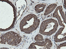 MIPEP Antibody in Immunohistochemistry (Paraffin) (IHC (P))