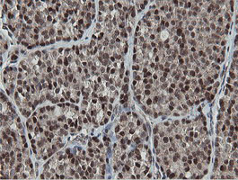 MIPEP Antibody in Immunohistochemistry (Paraffin) (IHC (P))