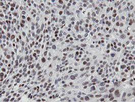 MIPEP Antibody in Immunohistochemistry (Paraffin) (IHC (P))