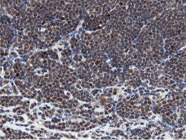 MIPEP Antibody in Immunohistochemistry (Paraffin) (IHC (P))