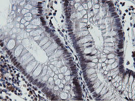 MIPEP Antibody in Immunohistochemistry (Paraffin) (IHC (P))