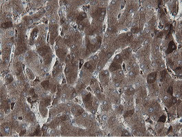 MIPEP Antibody in Immunohistochemistry (Paraffin) (IHC (P))