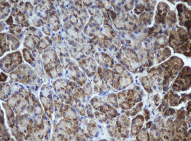 MIPEP Antibody in Immunohistochemistry (Paraffin) (IHC (P))