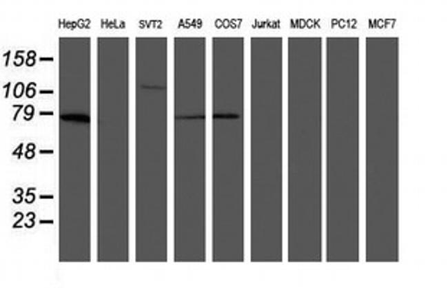 MIPEP Antibody in Western Blot (WB)