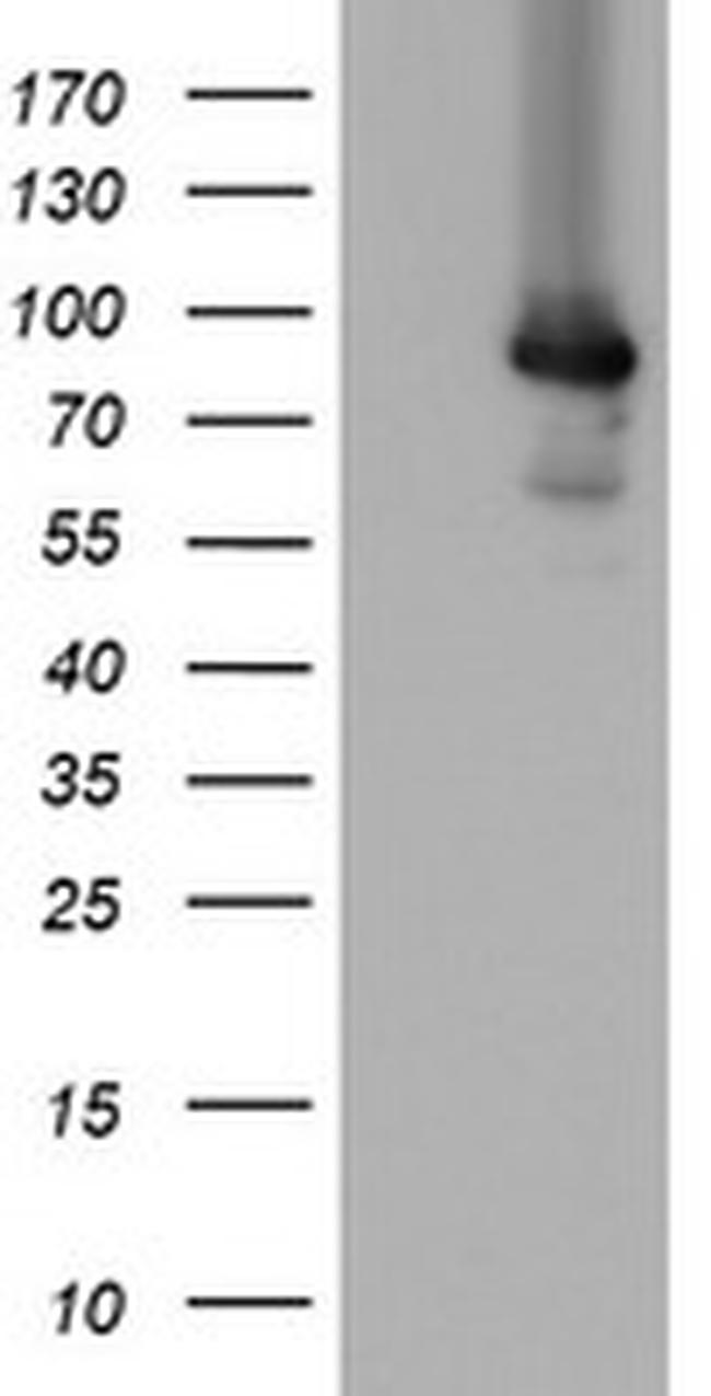 MIPEP Antibody in Western Blot (WB)