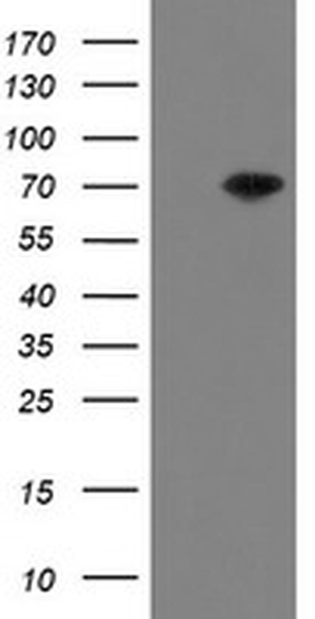 MIPEP Antibody in Western Blot (WB)