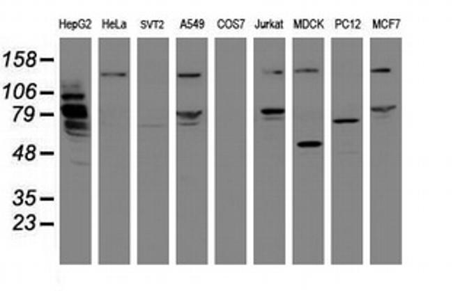 MIPEP Antibody in Western Blot (WB)