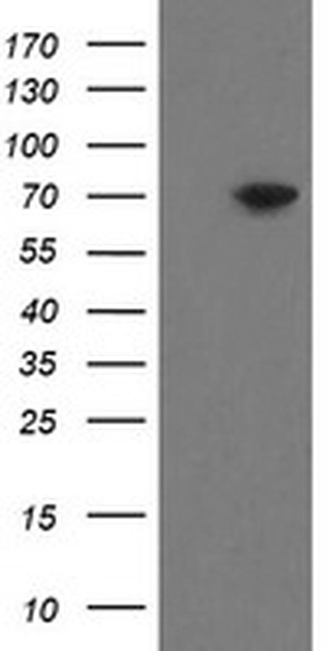 MIPEP Antibody in Western Blot (WB)