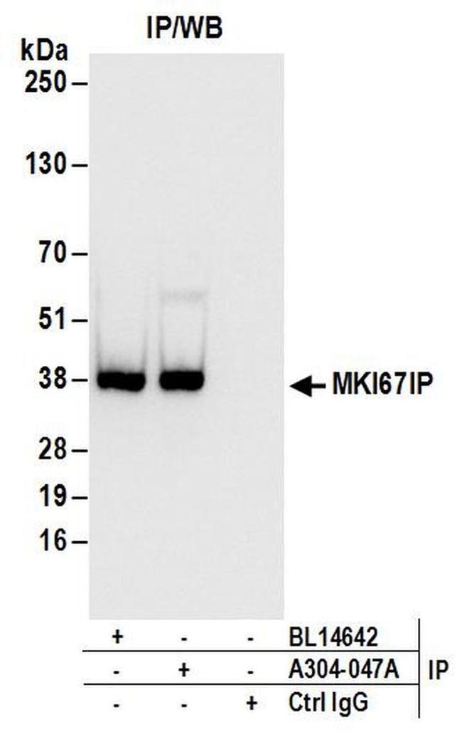 MKI67IP Antibody in Western Blot (WB)