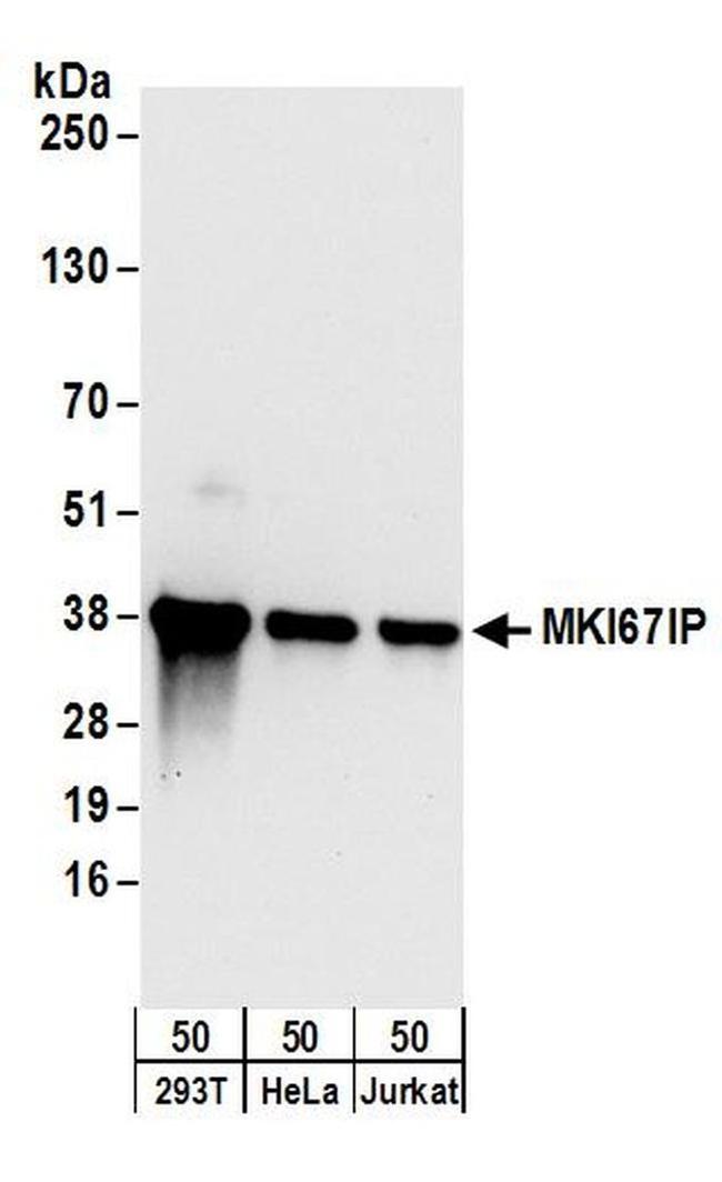 MKI67IP Antibody in Western Blot (WB)