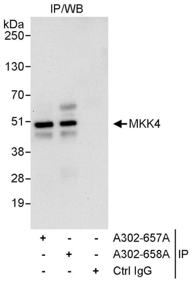 MKK4 Antibody in Immunoprecipitation (IP)