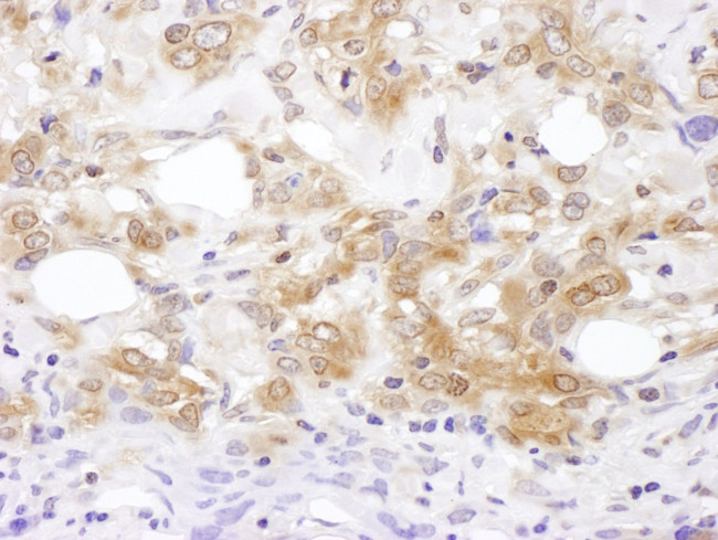 MKK7 Antibody in Immunohistochemistry (IHC)