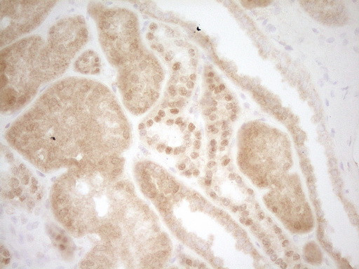 MKL1 Antibody in Immunohistochemistry (Paraffin) (IHC (P))