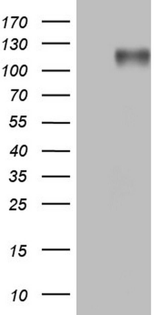 MKL1 Antibody in Western Blot (WB)