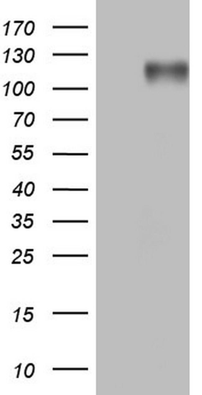 MKL1 Antibody in Western Blot (WB)