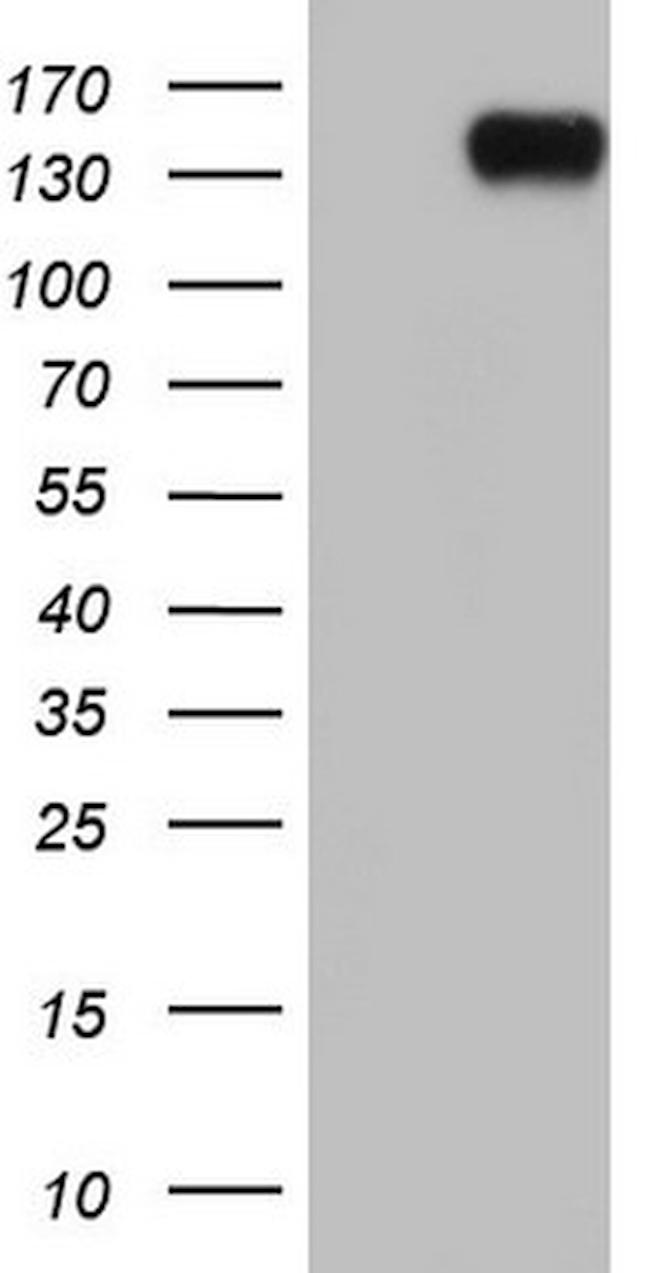 MKL1 Antibody in Western Blot (WB)