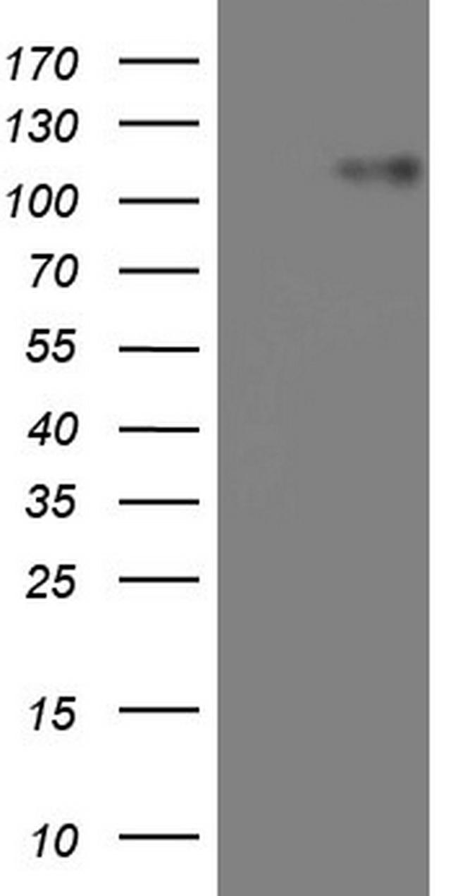 MKL1 Antibody in Western Blot (WB)